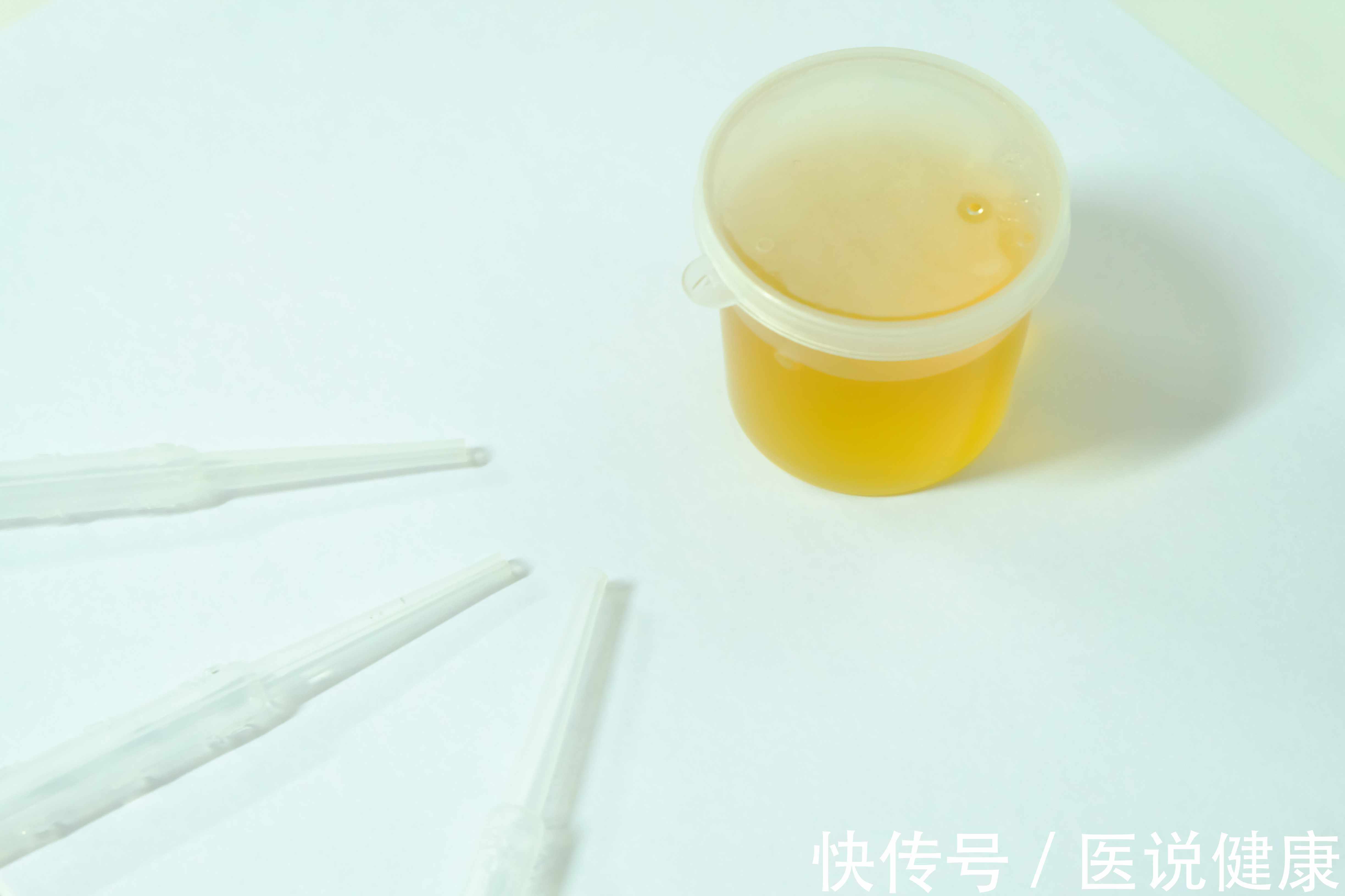 慢性肾衰竭|身体出现这7种信号,要重视起来,当心慢性肾衰竭找上门,需留心