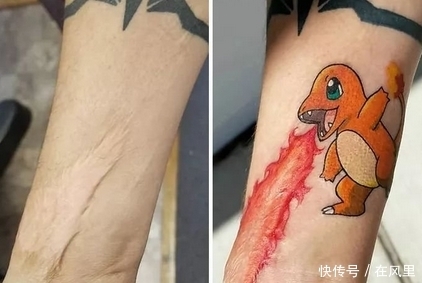 当丑陋的疤痕,遇上纹身师的智慧,原来疤痕也可以变得很美