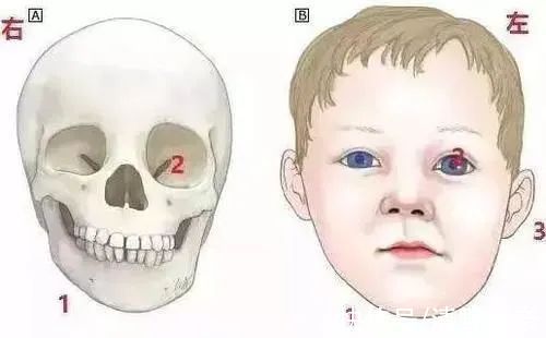 骨性 手机相机拍出的你是真实的吗？