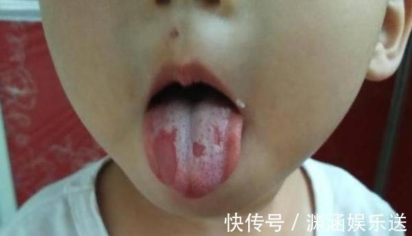 多糖|2个水果煮水,分分钟健脾强胃!孩子不蹬被,吃饭香,身高蹭蹭长