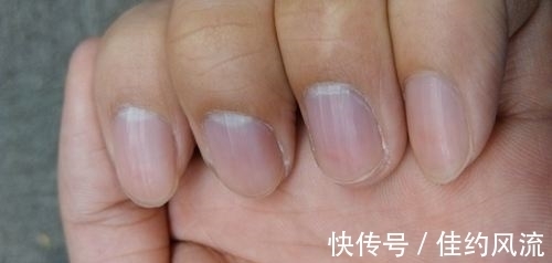 指甲|没有妇科问题的女性,手部通常会有以下3种特征显现