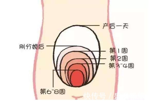 分娩|女性生没生过孩子,身上有4个记号,医生一眼就能看出