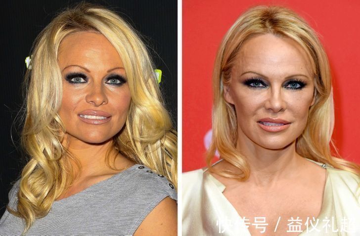 真实年龄|9个“直接戳破真实年龄”的衰老迹象,化妆也遮不住