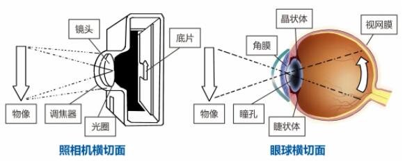 眼睛|眼睛长黄斑别大意！延误治疗时机当心失明