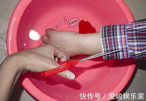 妈咪|4岁男童被烫伤,爸爸的处理方式被医生痛批,医生太无知了