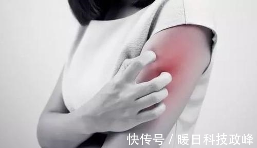 内分泌功能紊乱|46岁阿姨不痛不痒查出肺癌，医生：手上3种标记，已到中晚期