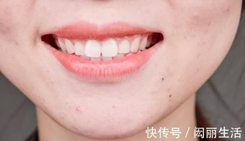 先知|血糖超标头先知头部出现哪些信号,暗示血糖可能已经失控了