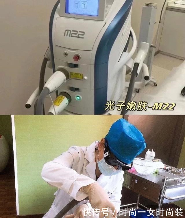 m22 半年内做了3次光子嫩肤,光子嫩肤真实反馈!