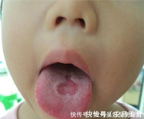 脾胃|超市几块钱东西是“天然消食物”,娃秋冬常吃,养好脾胃个子猛蹿