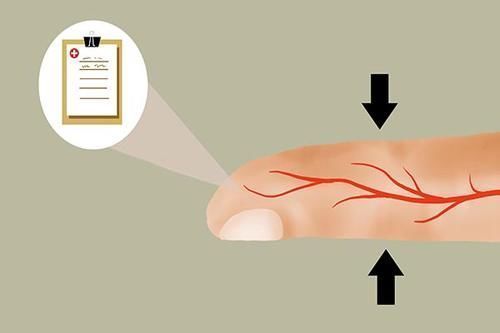 蔬菜|多吃菜能降血糖?2种菜若经常吃,血糖可能会一升再升,要少碰