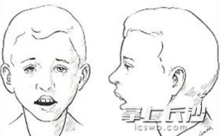 孩子睡觉|多名孩子美容觉变“丑容觉”，“颜值”问题为何要找耳鼻喉科？