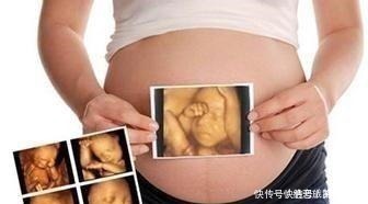 好处|孕期做四维有什么好处,什么时候做最好这个时候做是最好的