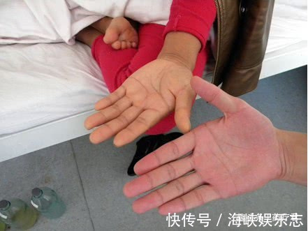 优质蛋白|患上尿毒症是吃出来的，医生忠告5种食物要少吃，肾会感激你