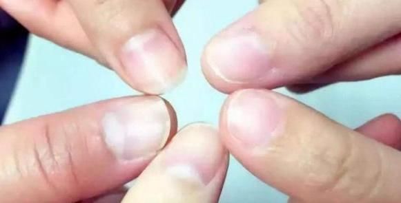 如果手上有3个“表现”,那就祝贺你了!肝脏是人体的主要器官!