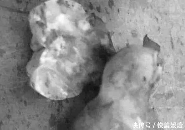 痘痘|小伙脸上慢慢鼓起大包,去医院检查,拍完的片子让医生很意外