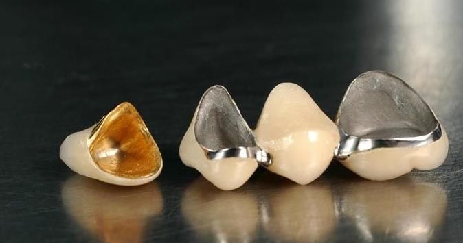 黄色|为何明星的牙齿白又齐, 普通人却“黄黄的”?牙医来告诉你