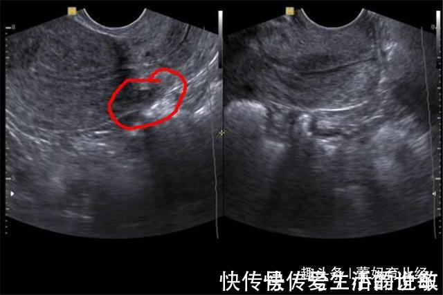 小玲|女子怀孕7个月，胎儿突然停止胎动？“嘴馋”或成罪魁祸首