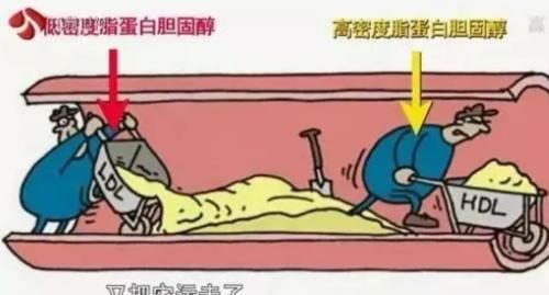 胆固醇|血管堵塞最致命！教你一招快速疏通，血管通了，一身轻松