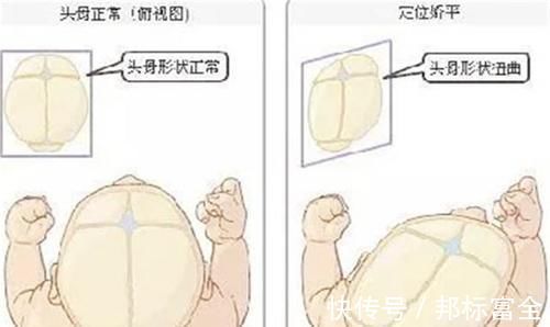 口腔|“黑脸宝宝”走红,长开后变成小帅哥,网友:还好父母忍住没扔