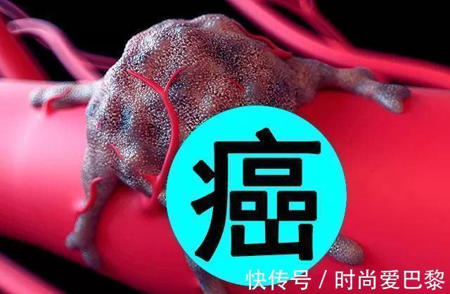 肿瘤患者|患癌不可怕,做到这三点,可“带瘤生存”,请收藏