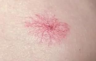 张大哥|43岁男子滴酒不沾，确诊肝癌，化疗4次离世，医生：这2物怎能常吃