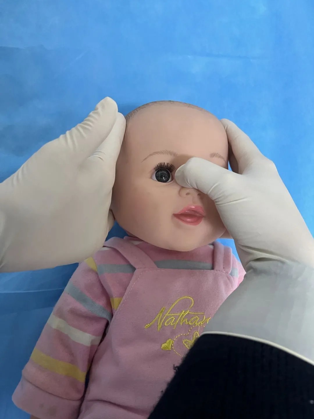 泪道|眼角抽出5管脓液，宝宝眼睛经常“泪汪汪”居然是病！拖延治疗严重的可能失明
