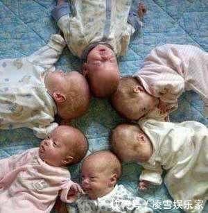 双胞胎|孕妈喜获6胞胎，看到孩子的性别，医生感叹这才是真正的金六福