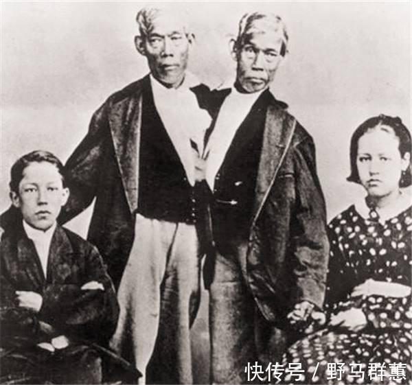 兄弟|这对华裔连体兄弟靠表演成名,娶了一对姐妹,生了22个孩子