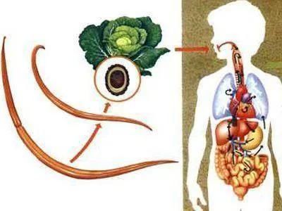 肠虫清|如何知道宝宝肚子里是否有蛔虫？