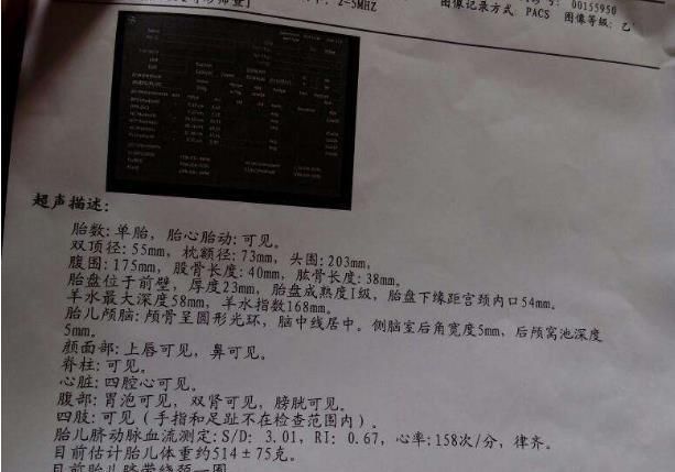 小琳|“脐带绕颈”只是因为胎儿调皮?还有这5件事,也会导致这种结果