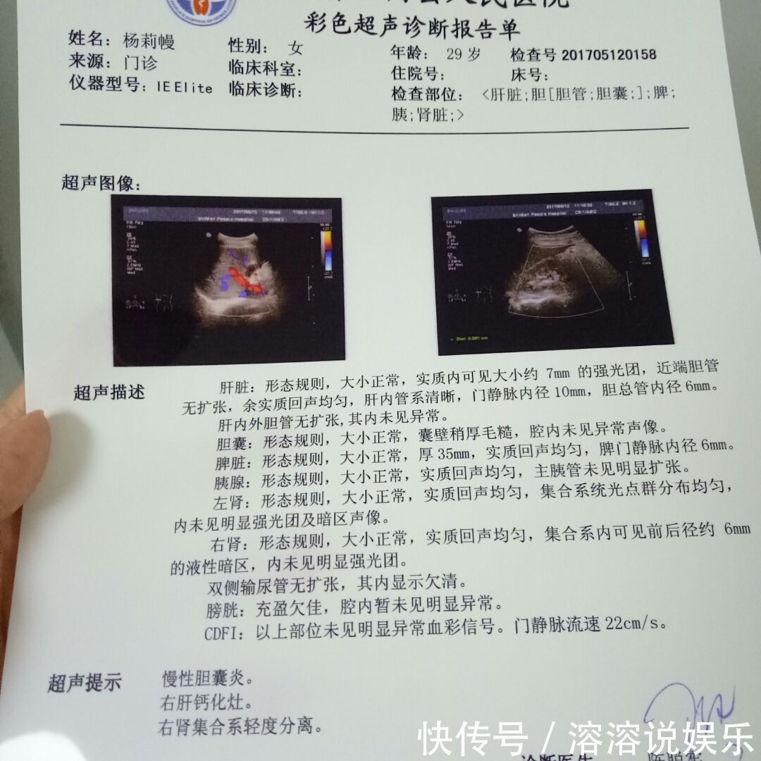 胎心|做B超时别再问医生胎宝宝性别了，是男是女，自己看单子也能分辨