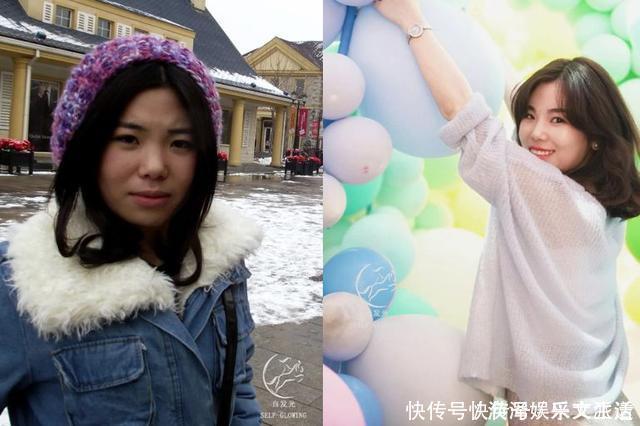 初恋这件小事|女明星注射面部逐渐“馒化”,要不要去整容?先问问她们再说吧!