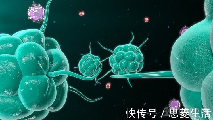 免疫细胞|重磅抗癌疫苗又获新突破,一名晚期癌症患者,5年无复发