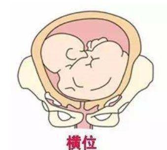 指数|怀孕时,孕妇的这三项“指数”不达标,是胎儿发育不良的信号!