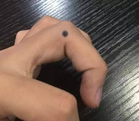 手上有四个穴位,可疗一切头疼,一起来了解一下吧