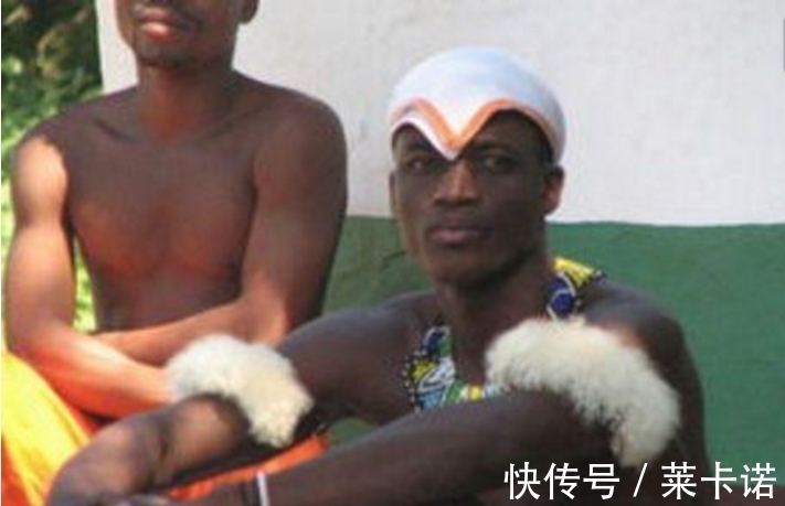 治疗|奇闻:男孩背上长龟壳,父亲要扔掉,治疗后成这个模样