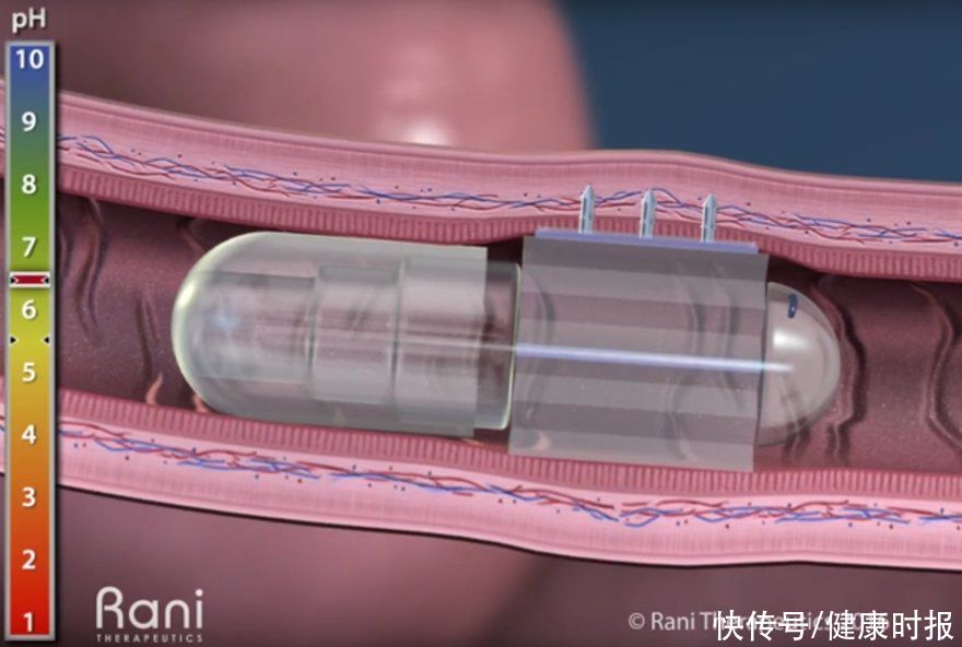 机器人|尝试将注射药物制成口服药丸，Rani 吸引多家药企争相注资
