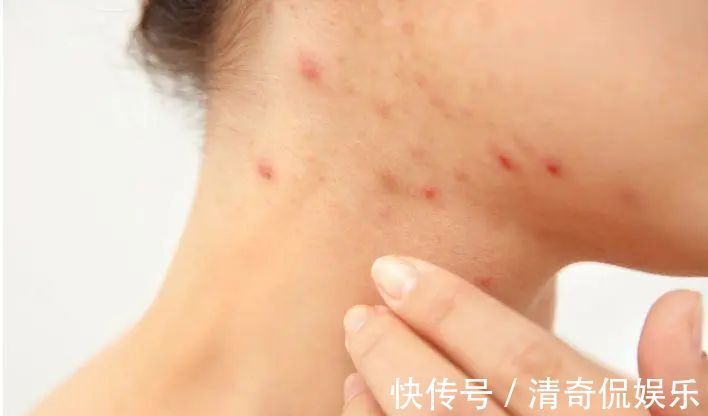 蒲公英根|春天，蒲公英，浑身是宝，对人体有4大好处，但3类人不宜吃