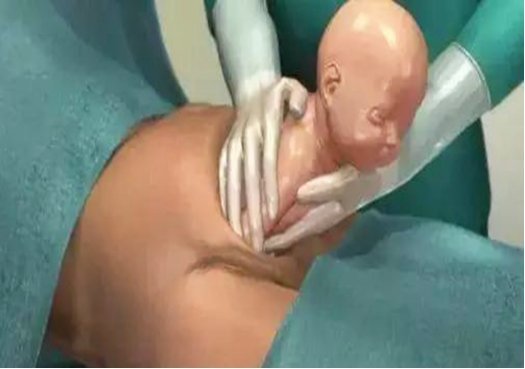 全过程|剖腹产不就是“划肚取胎”组图揭秘全过程,看完才懂母亲的伟大