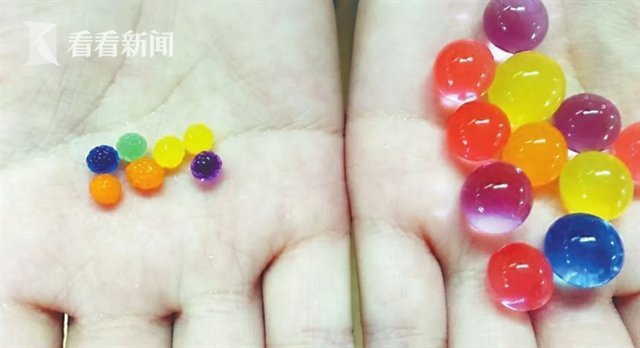 肠梗阻|1岁女童误把网红玩具当糖吞下 医生紧急手术取出