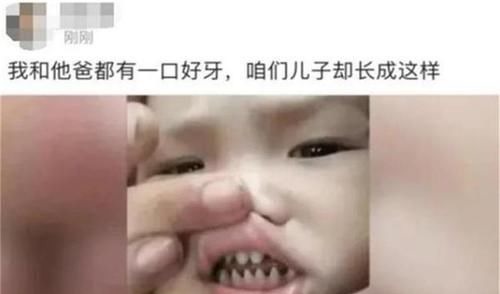 好习惯|孩子长出“鲨鱼牙”,妈妈疑惑送医检查,医生叹息家长太无知了