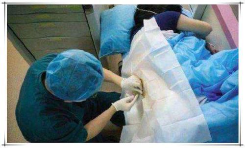 宝妈|宝妈剖腹产后总喊腰疼,看见剖腹产用的“针”,网友难怪了