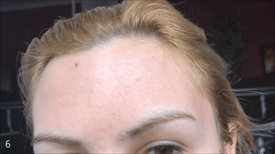 爱豆们竞当医美达人？男性适合的轻医美项目top5合集