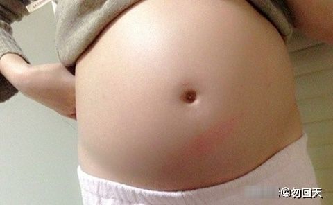 宝宝|孕妇在冬天容易犯这三个错,胎儿会不舒服,还可能缺氧