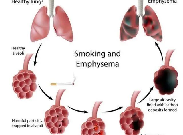 吸烟|男人身体“一处”越脏,寿命会越短,希望你没有
