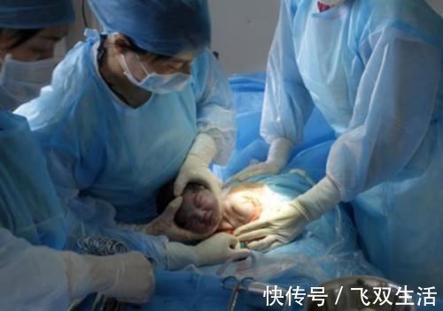 产力|剖腹产没有顺产恢复快,却有3大好处,顺产比不了,很多人不懂