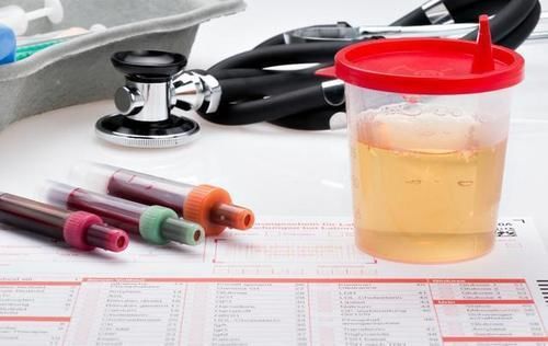 糖尿病人泡沫尿时有时无,是什么原因?本文为你说清