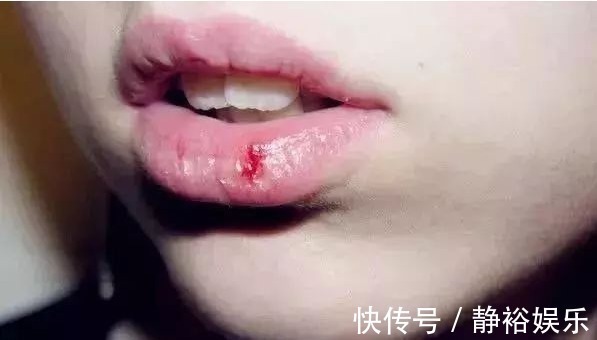 小知识 4个坏习惯让“嘴唇”越来越丑,涂口红都救不了,护唇也是抗衰