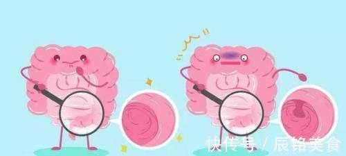 治疗方案|结肠癌晚期能活多久？会发生扩散吗？记住这些未雨绸缪！