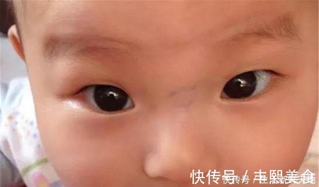 困难型|宝宝鼻梁上有“青筋”,体质差脾气也大别因误会忽略真正的诱因!